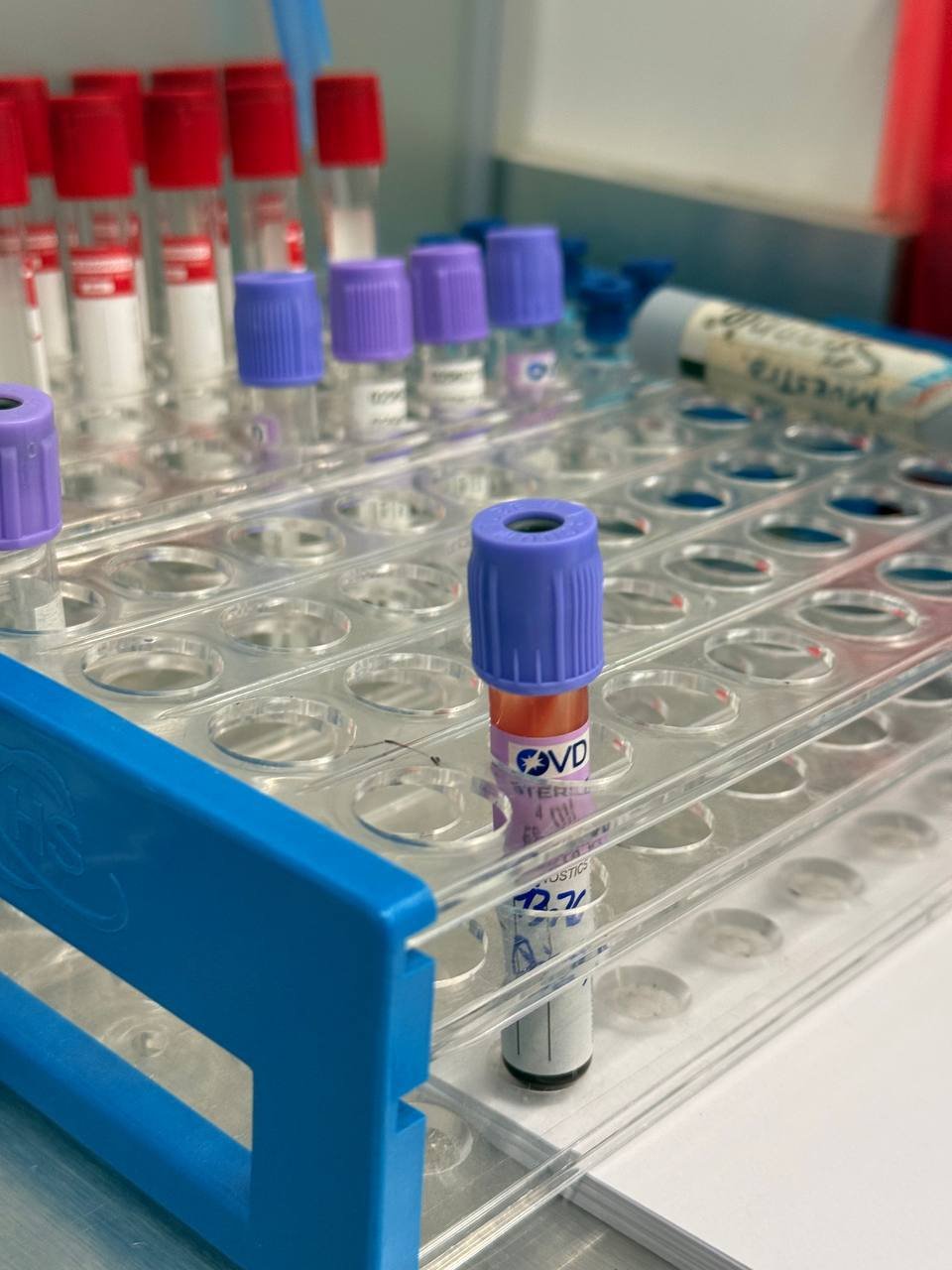 Procesamiento Seguro de Muestras Médicas en Mérida